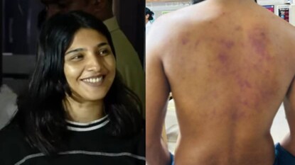 സഫ്ന, പരിക്കേറ്റ യുവാവ് സഫ്ന, പരിക്കേറ്റ യുവാവ്