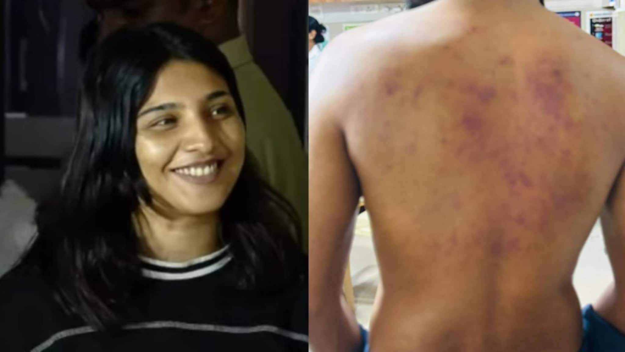 കൊച്ചിയിൽ ലൈംഗികബന്ധത്തിന് വിസമ്മതിച്ച ഭിന്നശേഷിക്കാരനായ യുവാവിന് ക്രൂരമർദനം