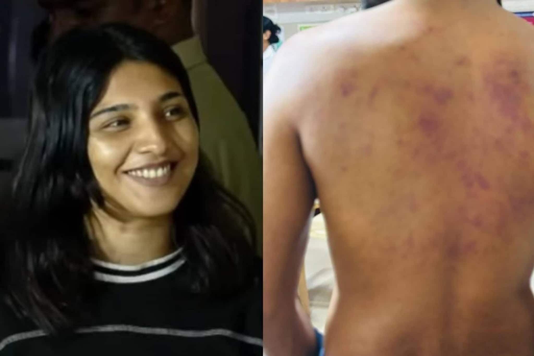 കൊച്ചിയിൽ ലൈംഗികബന്ധത്തിന് വിസമ്മതിച്ച ഭിന്നശേഷിക്കാരനായ യുവാവിന് ക്രൂരമർദനം