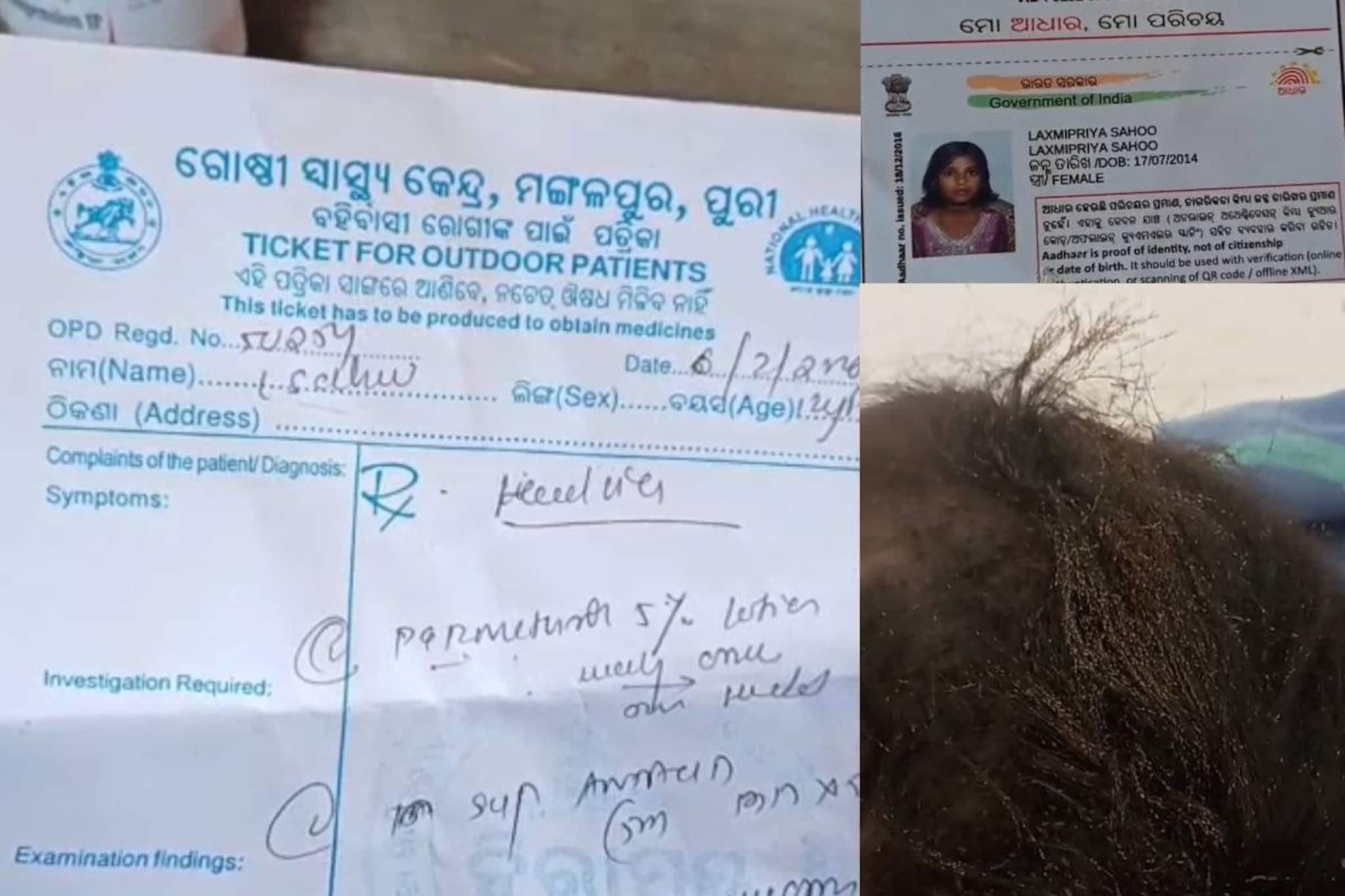 പേൻ ശല്യത്തെത്തുടർന്ന് അണുബാധ; 12 വയസുകാരി മരിച്ചു
