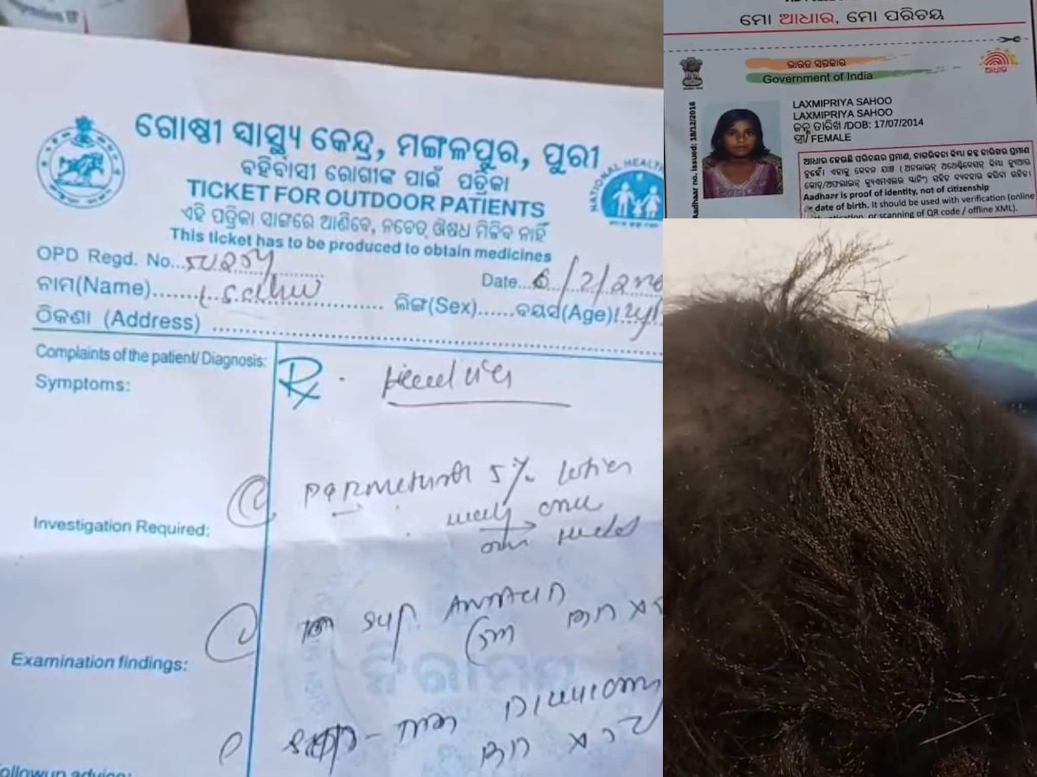 പേൻ ശല്യത്തെത്തുടർന്ന് അണുബാധ; 12 വയസുകാരി മരിച്ചു