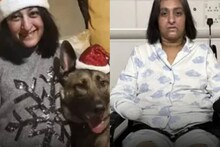 യുവതിയുടെ ചെറിയ മുറിവിൽ നായ നക്കി; കൈയും കാലും നഷ്ടമായി; സെപ്സിസിനെതിരെ കരുതൽ വേണം