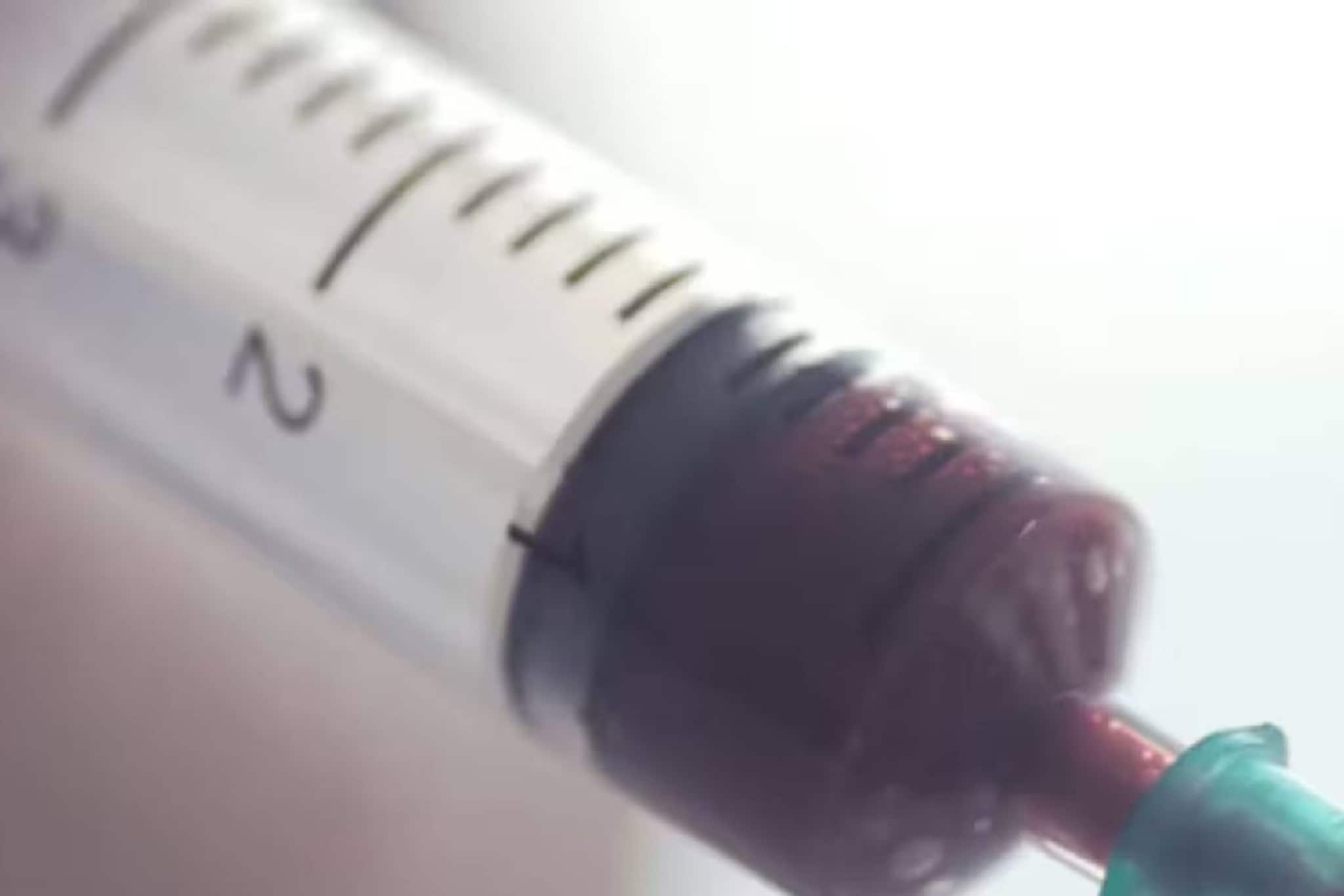 HIV ബാധിതനായ യുവാവ് വിവാഹത്തിൽ നിന്ന് പിന്മാറിയ യുവതിയിൽ തന്റെ രക്തം കുത്തിവെച്ചു HIV ബാധിതനായ യുവാവ് വിവാഹത്തിൽ നിന്ന് പിന്മാറിയ യുവതിയിൽ തന്റെ രക്തം കുത്തിവെച്ചു