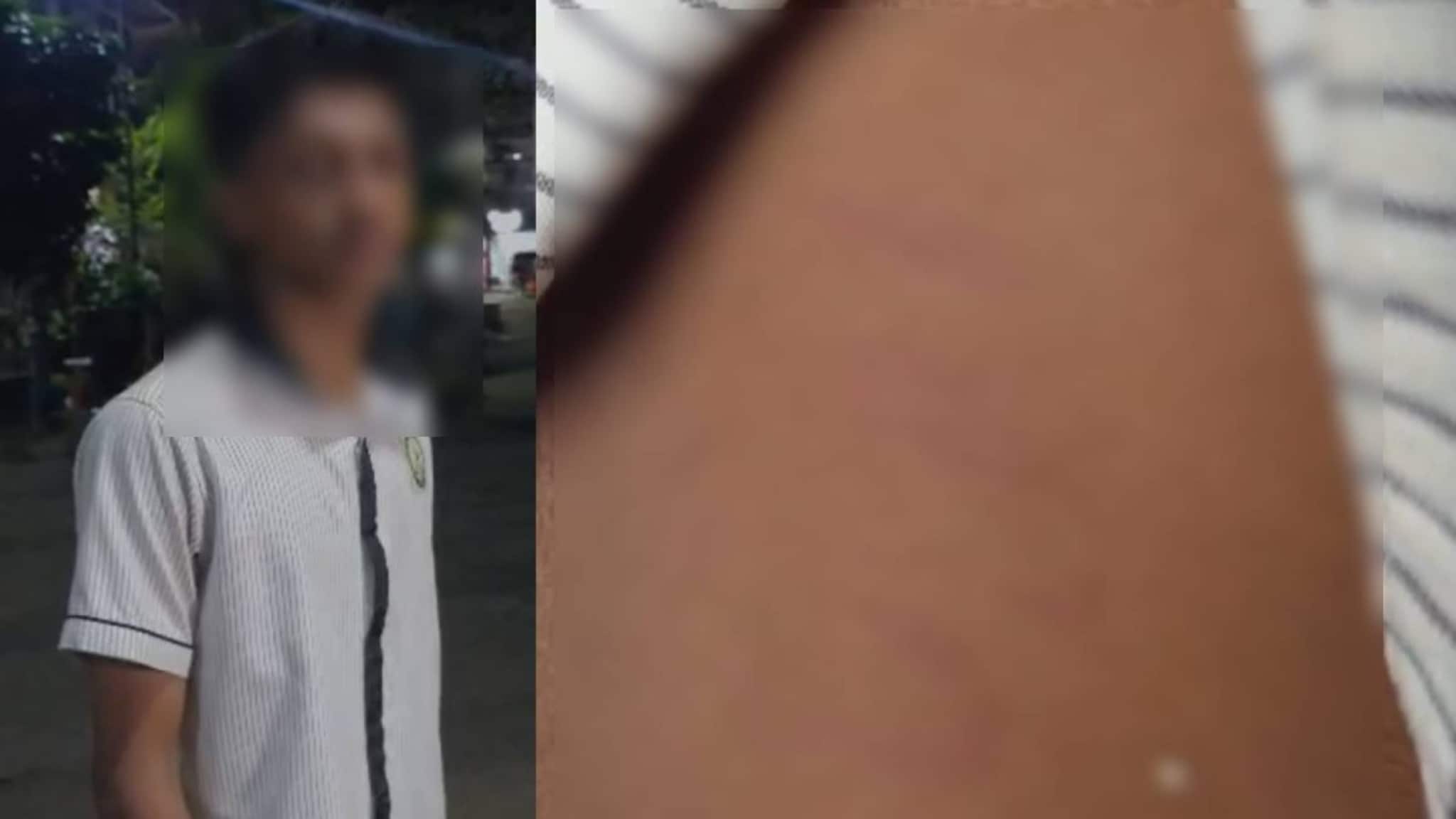 ചെരുപ്പും ഹെയർ സ്റ്റൈലും ഇഷ്ടപ്പെട്ടില്ല; കോഴിക്കോട് എട്ടാം ക്ലാസുകാരനെ 15ഓളം സീനിയർ വിദ്യാർത്ഥികൾ ക്രൂരമായി മർദിച്ചതായി പരാതി