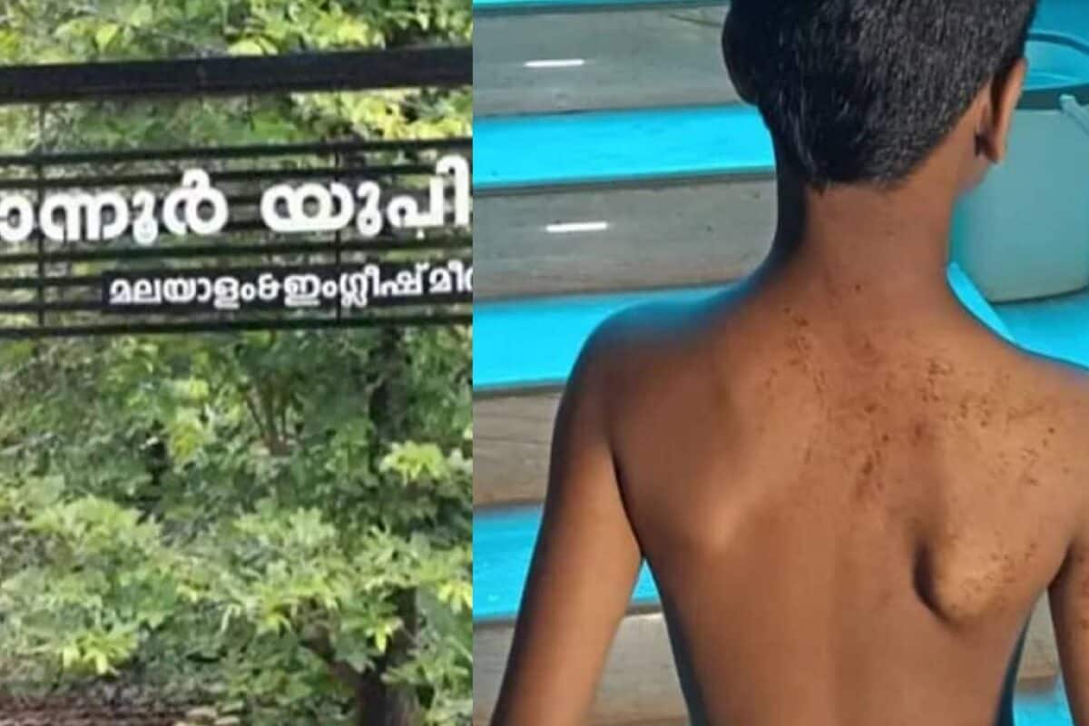 ബോർഡിലുള്ളത് പകർത്തിയെഴുതാൻ വൈകി; രണ്ടാം ക്ലാസുകാരനെ ക്രൂരമായി മർദ്ദിച്ച അദ്ധ്യാപകനെതിരെ കേസ്