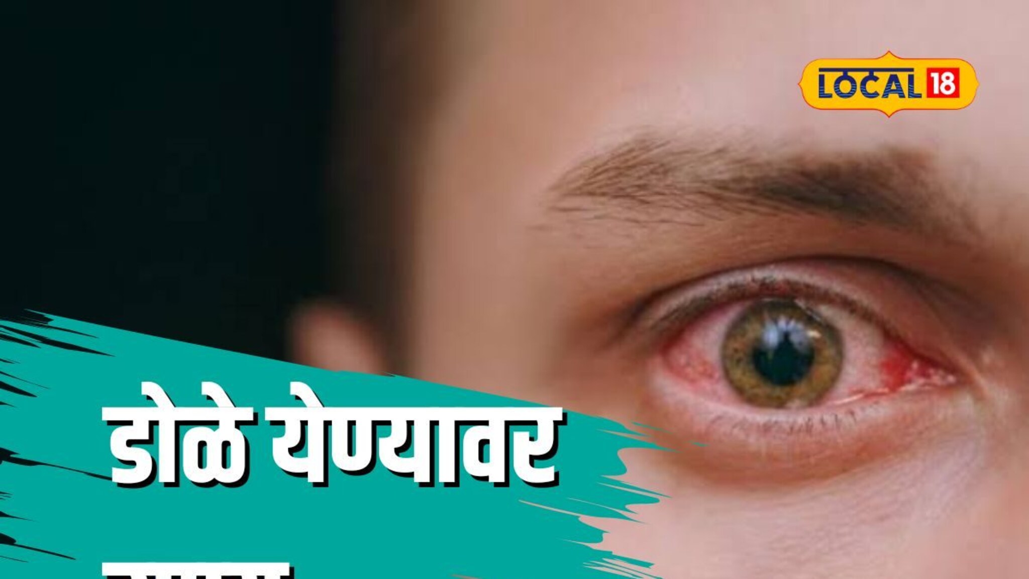 कोरोनानंतर आता या साथीचा धोका, डोळ्यांची काळजी घ्या