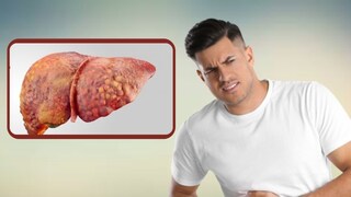 फॅटी लिव्हरकडे दुर्लक्ष करणं बेतू शकत जीवावर