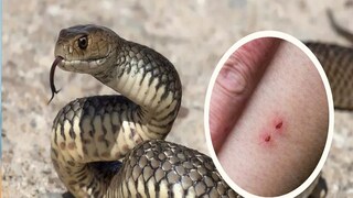 साप चावल्यावर कसा वाचवाल जीव? चुकूनही करू नका या गोष्टी साप चावल्यावर कसा वाचवाल जीव? चुकूनही करू नका या गोष्टी