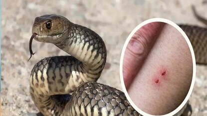 साप चावल्यावर कसा वाचवाल जीव? चुकूनही करू नका या गोष्टी साप चावल्यावर कसा वाचवाल जीव? चुकूनही करू नका या गोष्टी