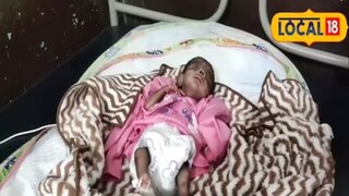 मुलांचं वजन जन्मतःच फार कमी असल्यामुळे डॉक्टरही चिंतेत होते.