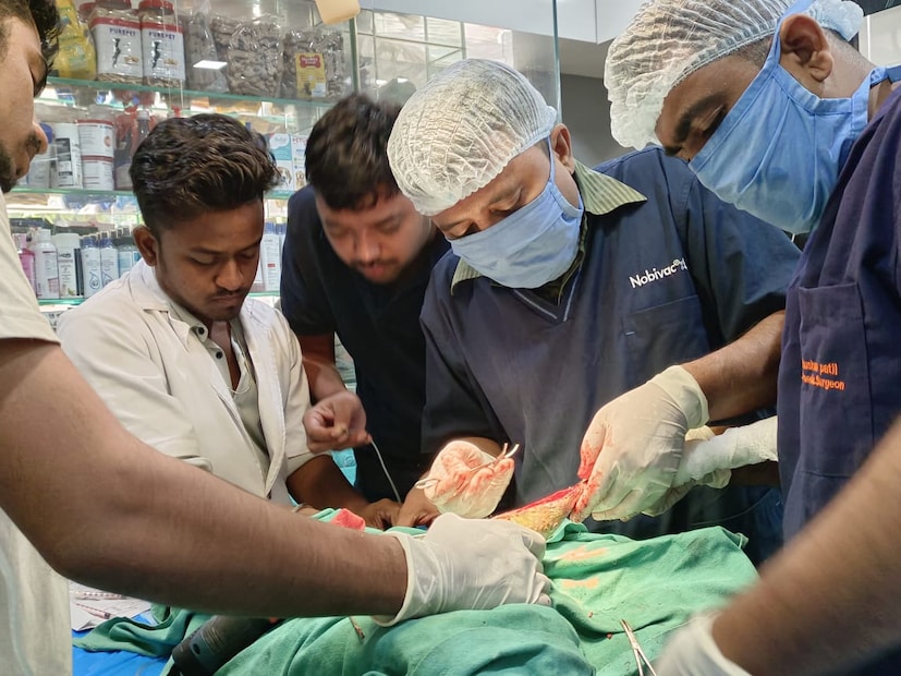  कमीत कमी वजनाची प्लेट वापरून ही शस्त्रक्रिया करण्यात आलीय. 