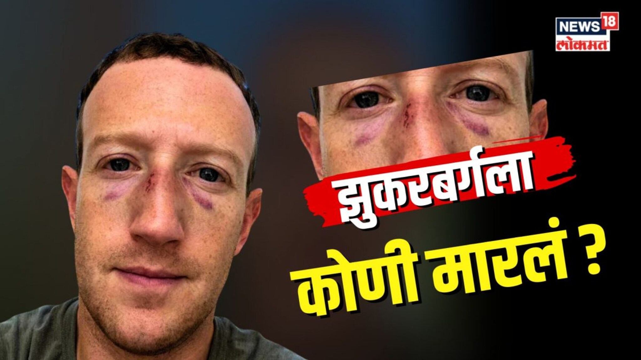मार्क झुकरबर्गवर कोणी केला हल्ला? फेसबुकच्या मालकाला कोणी केलं जखमी?