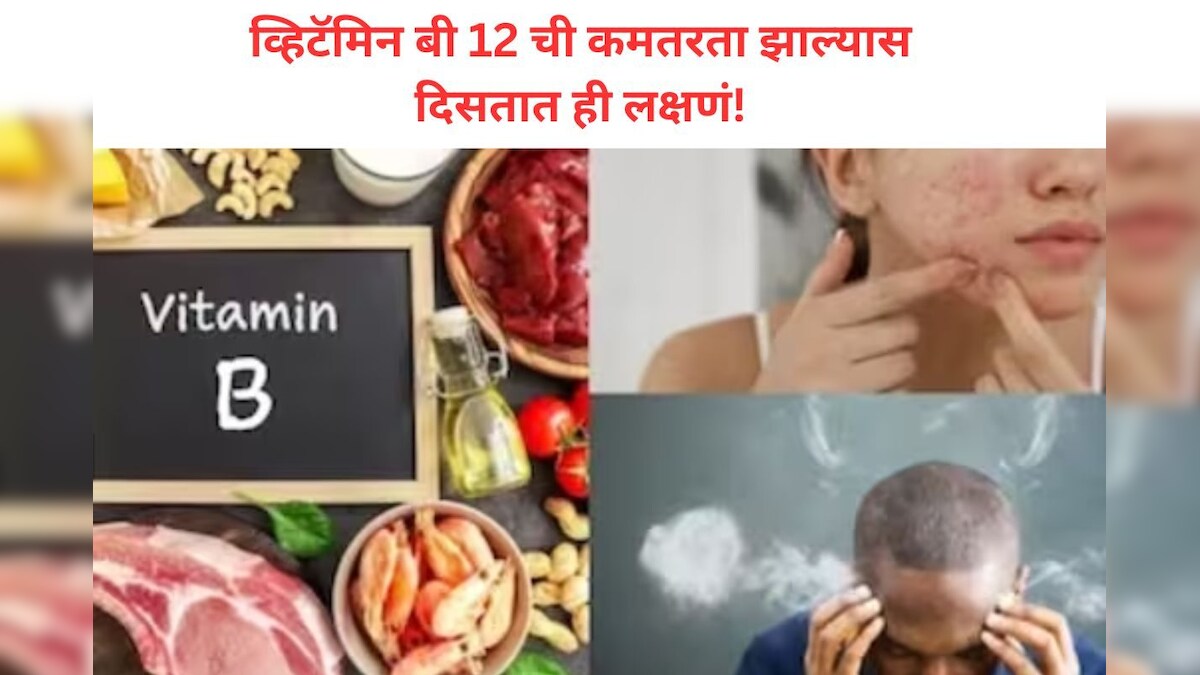Vitamin B 12 Deficiency व्हिटॅमिन बी 12 डिफिशिएन्सी म्हणजे काय? जाणून