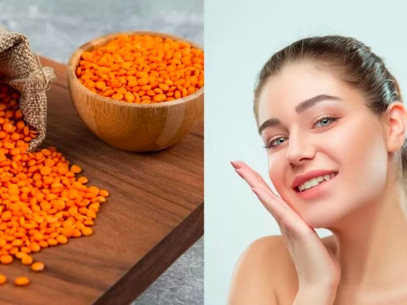 त्वचेशी संबंधित समस्या पिंपल्स, डाग आणि कोरडी त्वचा यापासून मसूरच्या डाळीने आराम मिळवता येऊ शकतो. मसूर डाळीने तुमच्या चेहऱ्यावर इन्स्टंट ग्लो येतो. धुळ, माती, मेकअप, वातावरणातील बदल आणि प्रदूषणाचा परिणाम झाल्यामुळे जर तुमची त्वचा काळवंडली असेल तर त्वचा उजळण्यासाठी मसूर डाळ तुम्ही नक्कीच वापरू शकता, असंही ब्युटिशियन सोनाली पाणबुडे सांगतात.