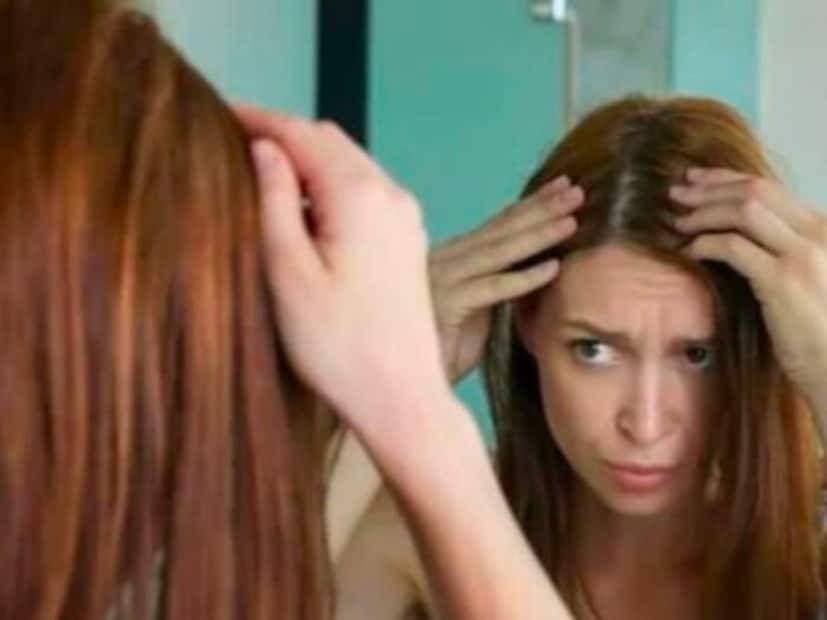 एखाद्या पॅकेटवर नॅचरल किंवा हर्बल असे लिहिले आहे त्यावर न जाता ती मेहंदी खरंच नॅचरल किंवा हर्बल आहे का अशी खात्री करून घेतल्यानंतरच ती मेहंदी केसांना लावावी, असेही डॉक्टर सुचवतात.