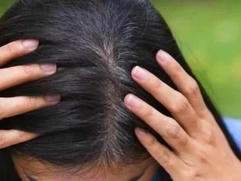 आजकाल केस पांढरे होण्यासाठी वय होण्याची वाट पाहावी लागत नाही. अगदी शालेय वय किंवा तरुणपणातही केस पांढरे होण्याचं प्रमाण वाढलं आहे. त्याची वेगवेगळी कारण असू शकतात. मात्र तुम्ही पांढरे केस काळे करण्यासाठी चुकीच्या पद्धती वापरत असाल तर ते नुकसानदायक ठरू शकतं.