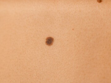 गालावर की भुवयांच्या शेवटी! महिलांच्या अंगावर या ठिकाणी तीळ असणं शुभ संकेत