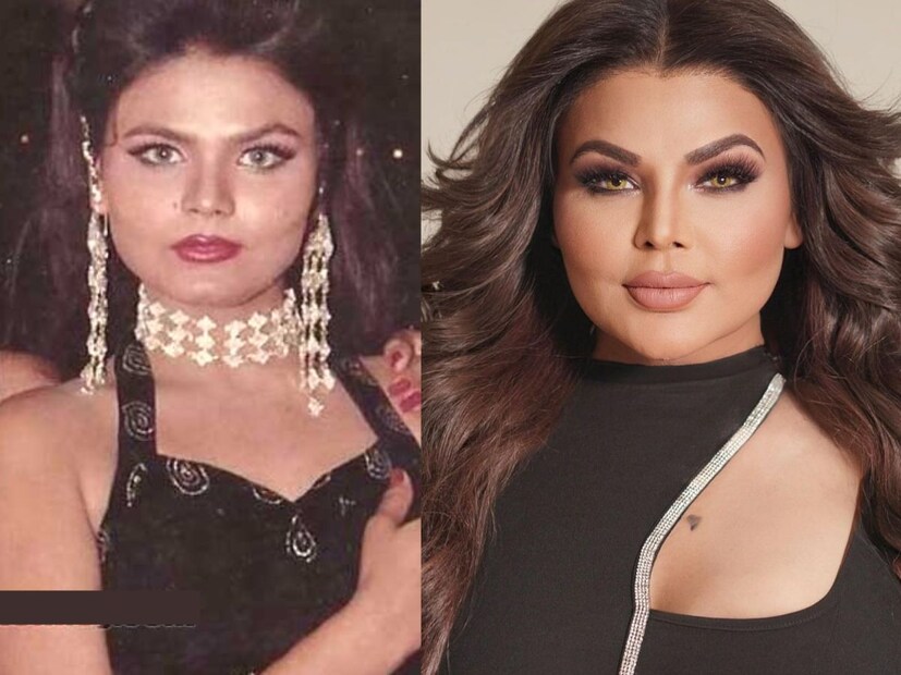  राखी लहान असताना त्यांना धड दोन वेळेसचं जेवणही मिळत नसे. लोकांनी फेकून दिलेल्या अन्नावर मायलेकी जगत होत्या. 