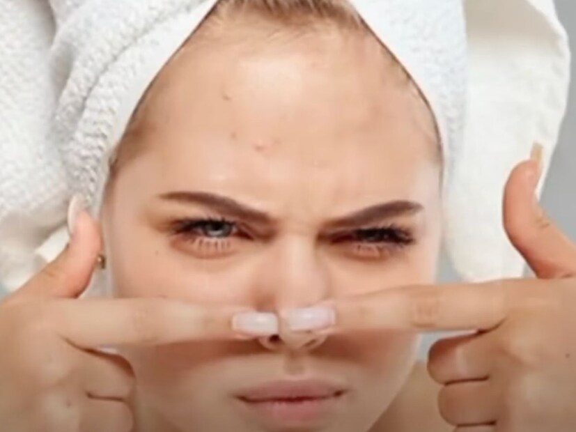 स्टीम घेत असताना कमीत कमी सहा इंचाचं अंतर गरम पाणी आणि आपल्या चेहऱ्यात असावं. खूप जास्त स्टीम घेतल्यास चेहऱ्यावर टॅनिंगही येऊ शकतं असा सल्ला चांदेकर यांनी दिलाय.