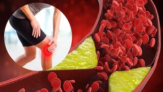 कोलेस्ट्रॉल