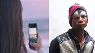 (नवऱ्याच्या डोळ्याला मोठी जखम)