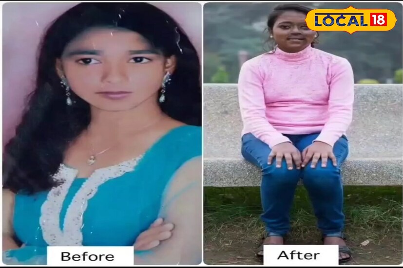 उत्तर प्रदेशच्या रामबागेत राहणाऱ्या या तरुणीवर तिच्याच परिसरात राहणारा 35 वर्षीय प्रदीप खूप प्रेम करायचा. त्याचं हे प्रेम नव्हतं, तर विकृती होती. तो तिला येता-जाता त्रास द्यायचा. तरुणीने याबाबत तिच्या आईला सांगितलं असता आईने त्याला त्याच्या घरी जाऊन खडसावलं. त्यावर प्रदीप प्रचंड संतापला. त्याच्या विकृतीने टोक गाठलं. तो थेट तिच्या घरी गेला. त्यावेळी तरुणी आपल्या भावंडांसोबत कॅरम खेळत होती. कोणाला काही कळायच्या आत प्रदीपने तिच्या चेहऱ्यावर अॅसिड फेकलं. त्यात तरुणीला गंभीर जखमा झाल्या. तिचं आयुष्यात होत्याचं नव्हतं झालं. उत्तर प्रदेशच्या रामबागेत राहणाऱ्या या तरुणीवर तिच्याच परिसरात राहणारा 35 वर्षीय प्रदीप खूप प्रेम करायचा. त्याचं हे प्रेम नव्हतं, तर विकृती होती. तो तिला येता-जाता त्रास द्यायचा. तरुणीने याबाबत तिच्या आईला सांगितलं असता आईने त्याला त्याच्या घरी जाऊन खडसावलं. त्यावर प्रदीप प्रचंड संतापला. त्याच्या विकृतीने टोक गाठलं. तो थेट तिच्या घरी गेला. त्यावेळी तरुणी आपल्या भावंडांसोबत कॅरम खेळत होती. कोणाला काही कळायच्या आत प्रदीपने तिच्या चेहऱ्यावर अॅसिड फेकलं. त्यात तरुणीला गंभीर जखमा झाल्या. तिचं आयुष्यात होत्याचं नव्हतं झालं.
