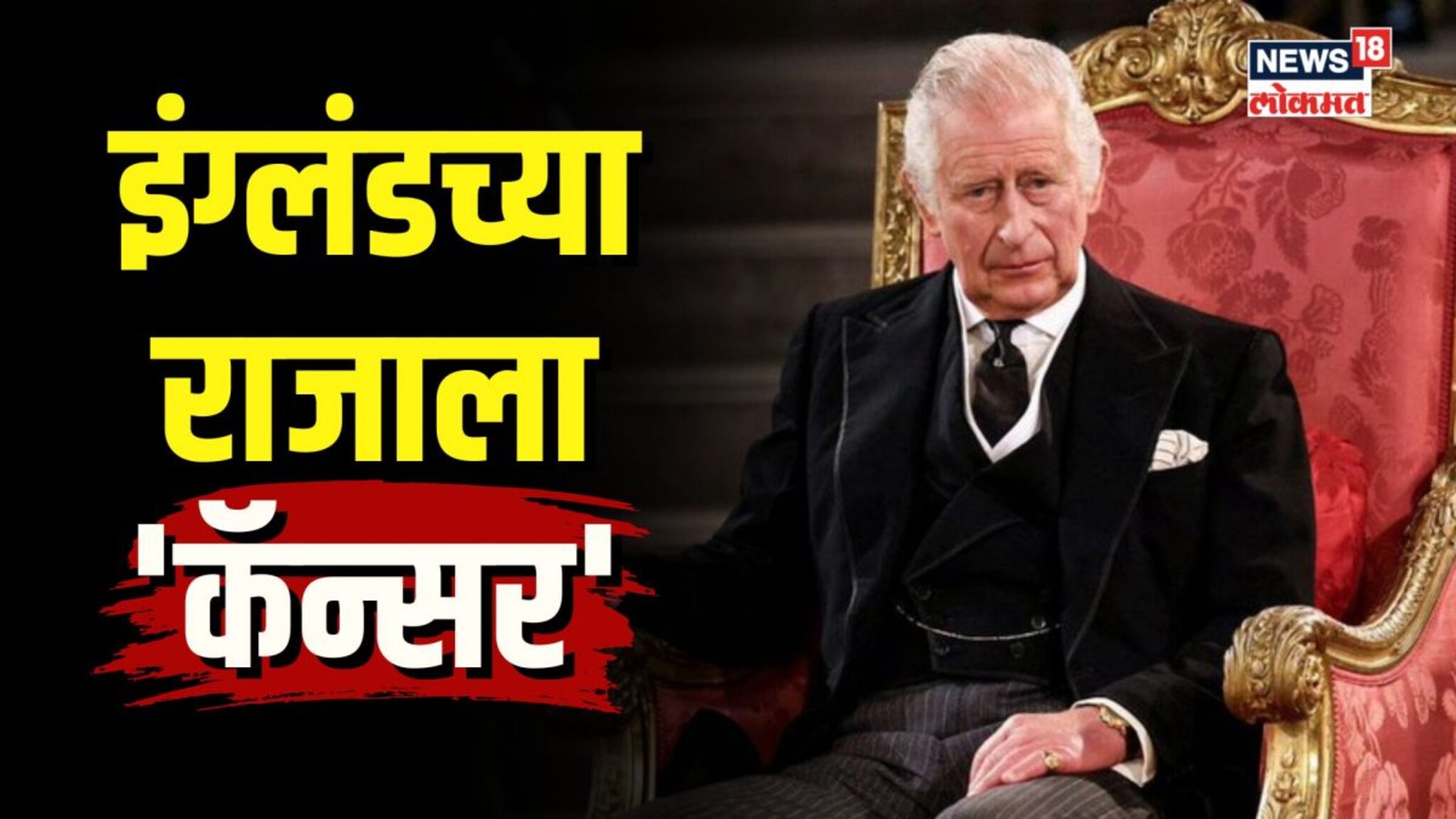 इंग्लंडच्या राजाला कॅन्सरनं गाठलं! कशी आहे किंग चार्ल्स याची तब्येत?