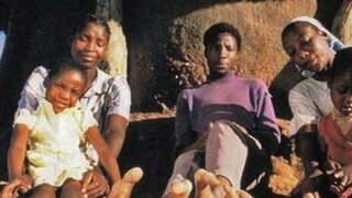 पक्ष्यांसारखे आहेत पाय