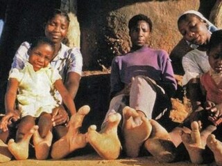 पक्ष्यांसारखे आहेत पाय पक्ष्यांसारखे आहेत पाय