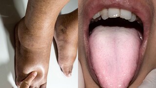 शरिरात दिसणारी 5 लक्षण आहेत गंभीर आजारांचे संकेत