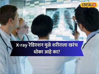 प्रतिकात्मक फोटो प्रतिकात्मक फोटो