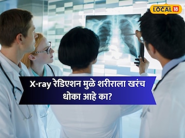 प्रतिकात्मक फोटो प्रतिकात्मक फोटो