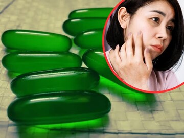 डोळ्यांखालची काळी वर्तुळं काही दिवसात होतील गायब, असे वापरा व्हिटॅमिन ई कॅप्सूल