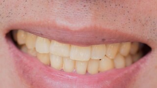 प्रतिकात्मक फोटो