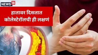 Cholesterol Symptoms: हाता-पायांवर दिसतात कोलेस्ट्रॉलची ही लक्षणं, अजिबात करू नका दुर्लक्ष..