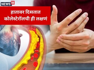 Cholesterol Symptoms: हाता-पायांवर दिसतात कोलेस्ट्रॉलची ही लक्षणं, अजिबात करू नका दुर्लक्ष..