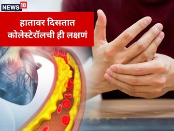 Cholesterol Symptoms: हाता-पायांवर दिसतात कोलेस्ट्रॉलची ही लक्षणं, अजिबात करू नका दुर्लक्ष.. Cholesterol Symptoms: हाता-पायांवर दिसतात कोलेस्ट्रॉलची ही लक्षणं, अजिबात करू नका दुर्लक्ष..