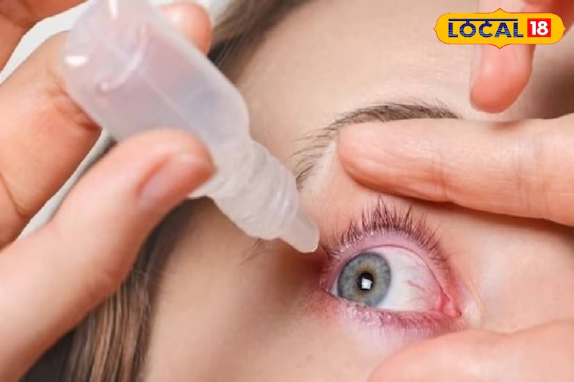 उन्हापासून डोळ्यांचे रक्षण करणे आणि संपूर्ण उन्हाळ्यात त्यांना ताजेतवाने ठेवणे महत्त्वाचे ठरते. त्यासाठी उन्हाळ्यात आपल्या डोळ्यांची काळजी कशी घ्यावी? यासंदर्भात वर्धा येथील नेत्ररोगतज्ज्ञ डॉ. प्रणय शिंदे यांनी माहिती दिली आहे.