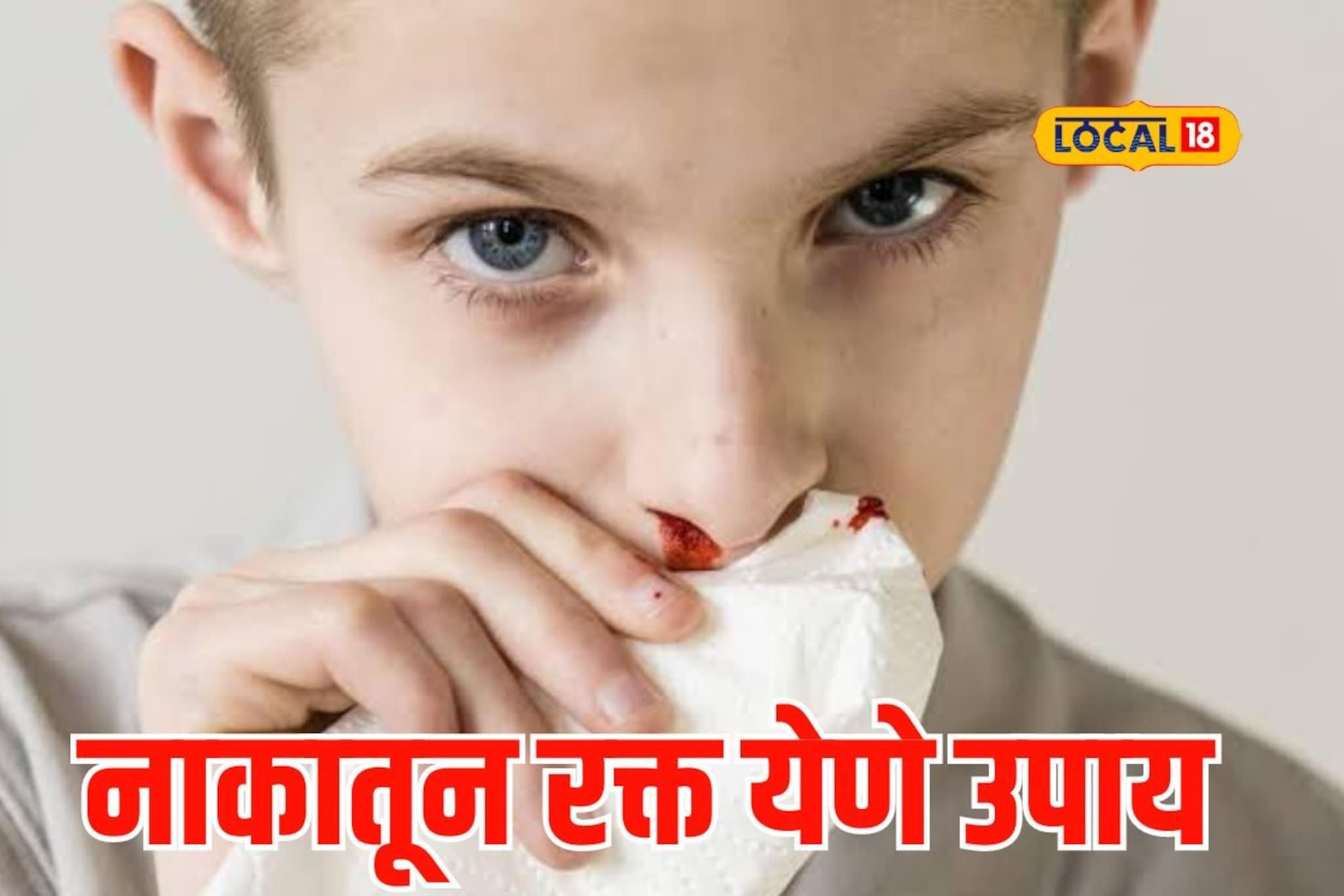 उन्हाळ्यात नाकातून रक्त येतंय? घोळणा फुटल्यावर करा हा उपाय, Video