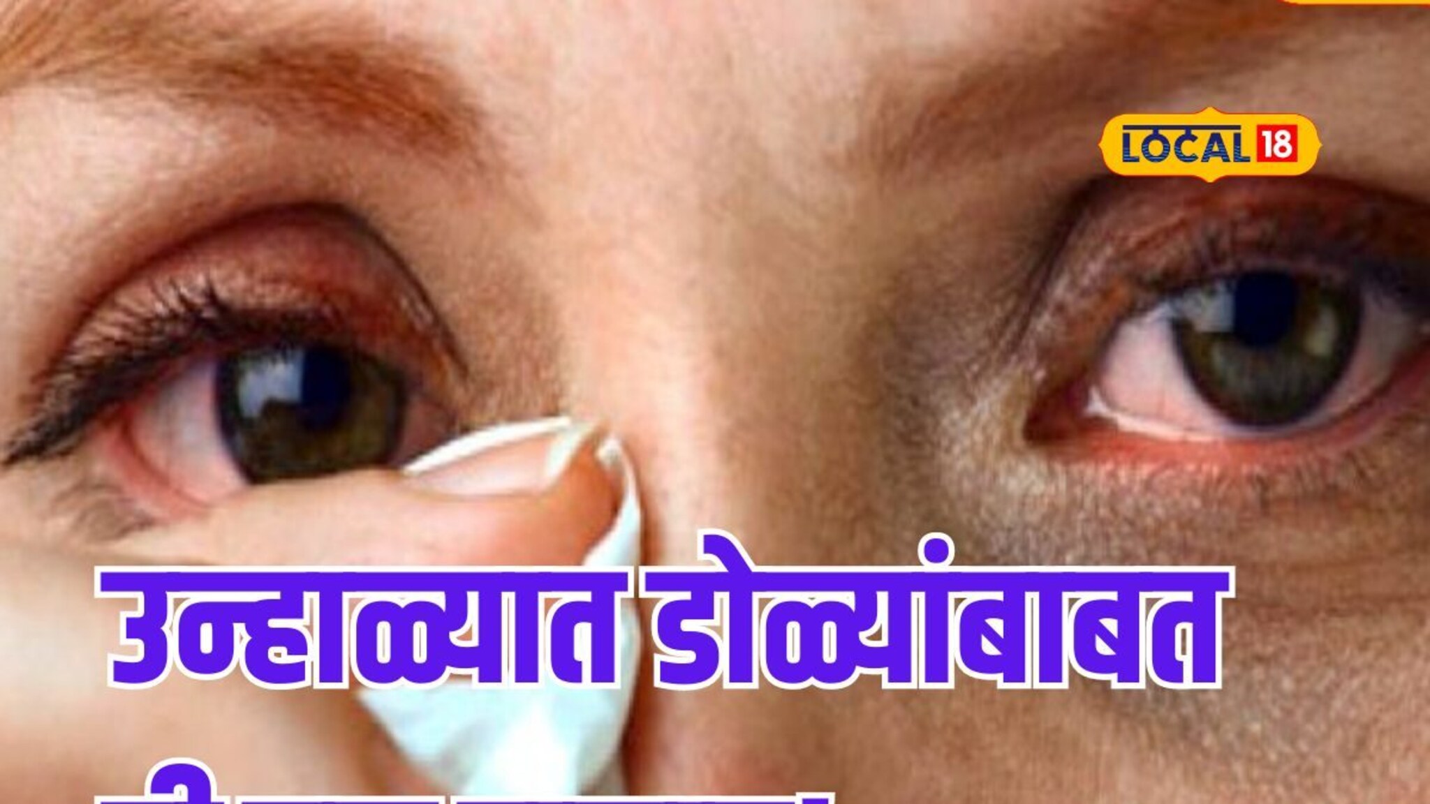 उन्हाळ्यात डोळ्यांत आग आणि जळजळ होतेय? मग अशी घ्या काळजी