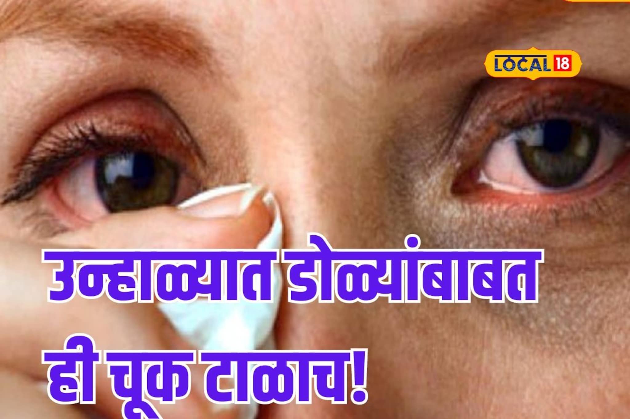 उन्हाळ्यात डोळ्यांत आग आणि जळजळ होतेय? मग अशी घ्या काळजी