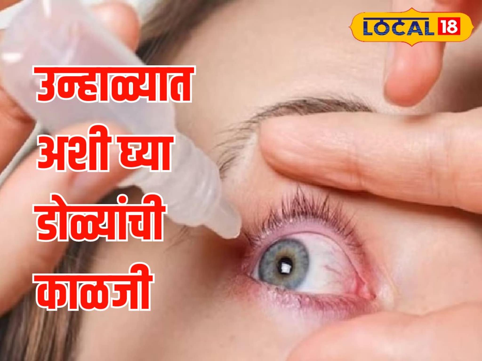 उन्हाळ्यात डोळ्यांना त्रास होतोय? ही चूक अजिबात करू नका! Video