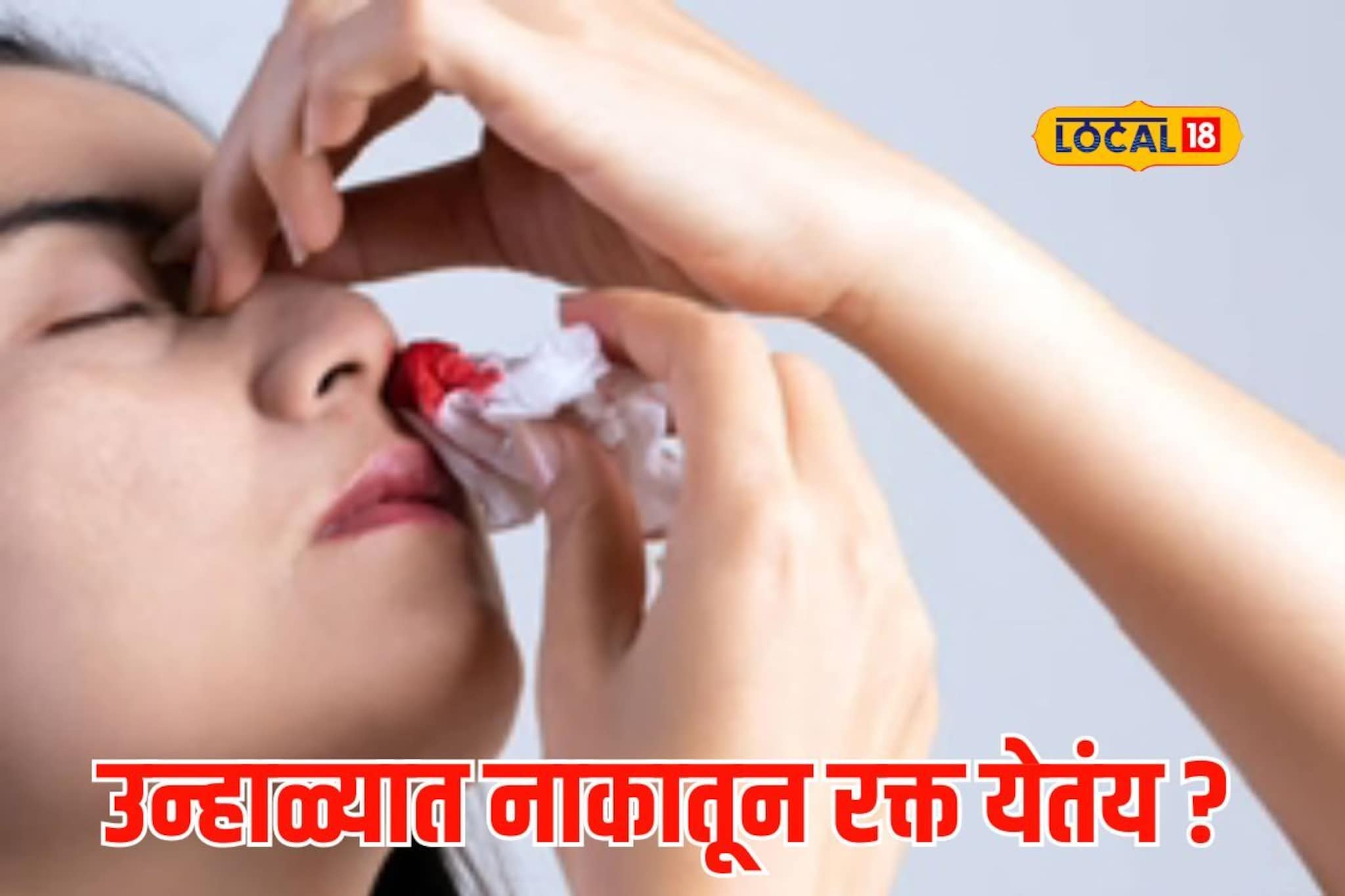 उन्हाळ्यात घोळणा फुटण्याचा धोका, रक्तस्त्राव टाळण्यासाठी पाहा घरगुती उपाय