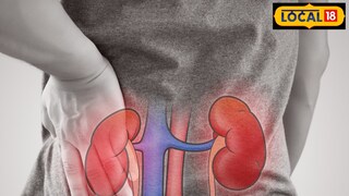 मूतखड्यांवर उपाय काय?