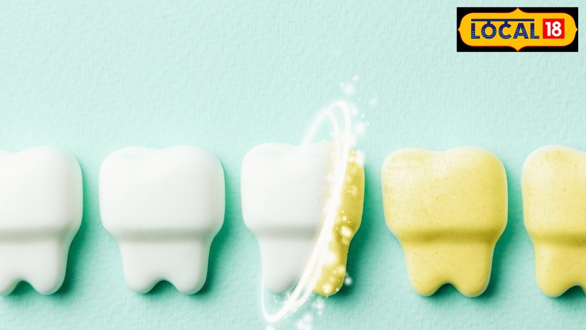 जोपर्यंत दातांचं दुखणं दूर होत नाही, तोपर्यंत उपाय करावा. 