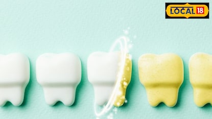 जोपर्यंत दातांचं दुखणं दूर होत नाही, तोपर्यंत उपाय करावा. जोपर्यंत दातांचं दुखणं दूर होत नाही, तोपर्यंत उपाय करावा.