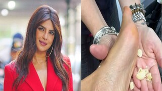 पायावर लसूण चोळण्याचे फायदे तुम्हाला माहितीयेत का? प्रियांका चोप्रा सुद्धा करते हा उपाय