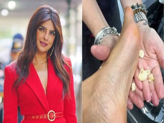 पायावर लसूण चोळण्याचे फायदे तुम्हाला माहितीयेत का? प्रियांका चोप्रा सुद्धा करते हा उपाय