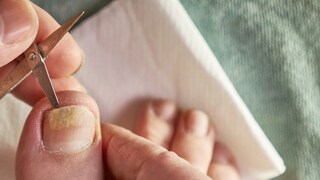 या टीप्स वापरुन घ्या त्वचेची काळजी! या टीप्स वापरुन घ्या त्वचेची काळजी!