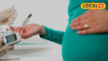 प्रतिकात्मक